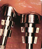 Clinical Picture Abutment Impression Pick-up