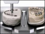 Máquina de Precisión Cresco™, alturas deseadas
