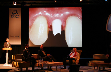 Professor Lyndon Cooper presenting a case with the Astra Tech Implant System and Atlantis.