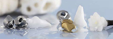 Atlantis™ abutments